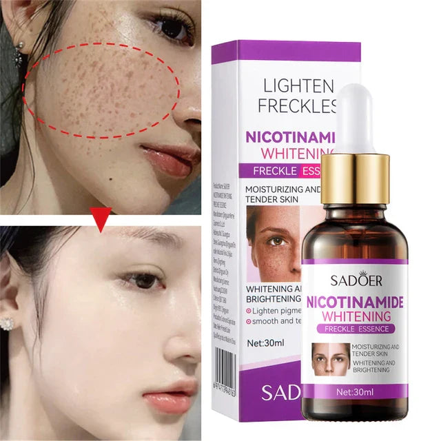 SADOER Nicotinamide Whitening Freckles Serum 30ml