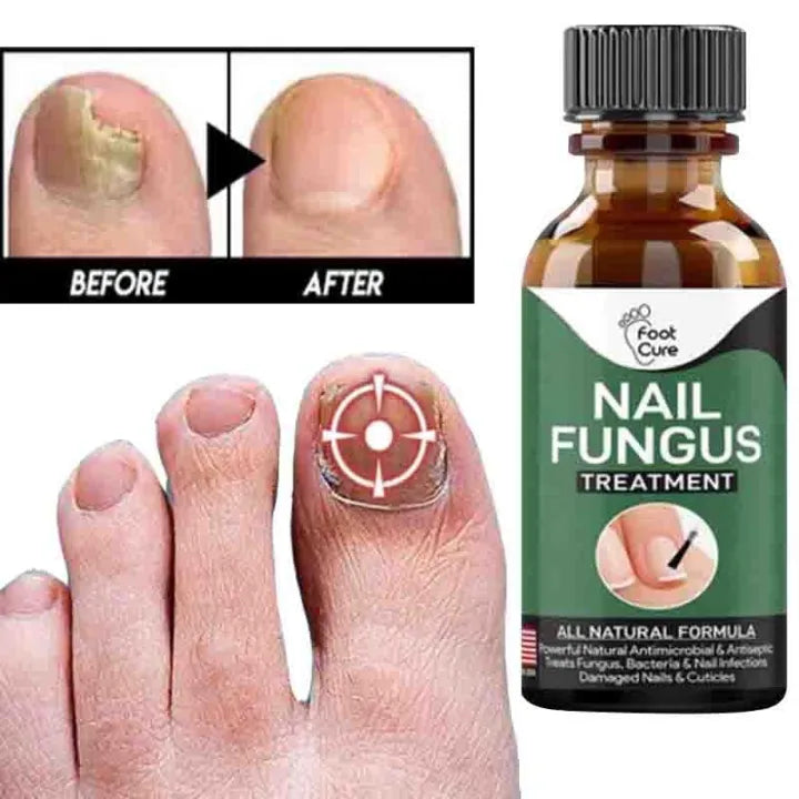 Nail Fungal Repair Serum
