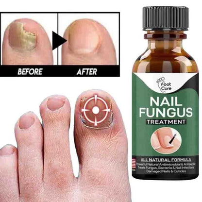 Nail Fungal Repair Serum